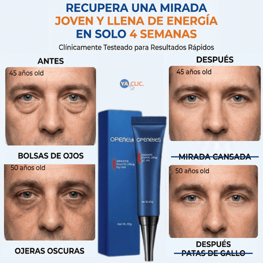 OpenEyes®  Colágeno + Ácido Hialurónico | Elimina la fatiga ocular.